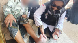 Kaki jemaah melepuh karena berjalan tanpa alas kaki di Madinah. (Foto: Kemenag/ Hikmah Romalina) 