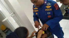 Seorang anak perempuan mengalami luka gigitan anjing liar di kawasan wisata Pantai Air Manis, Kota Padang, Kamis (19/3/2026). (Foto: Diskominfo Padang)
