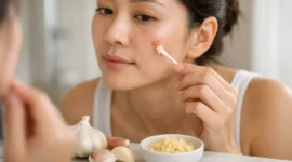 Penggunaan bawang putih untuk mengatasi jerawat. (Foto: Website alodokter.com)